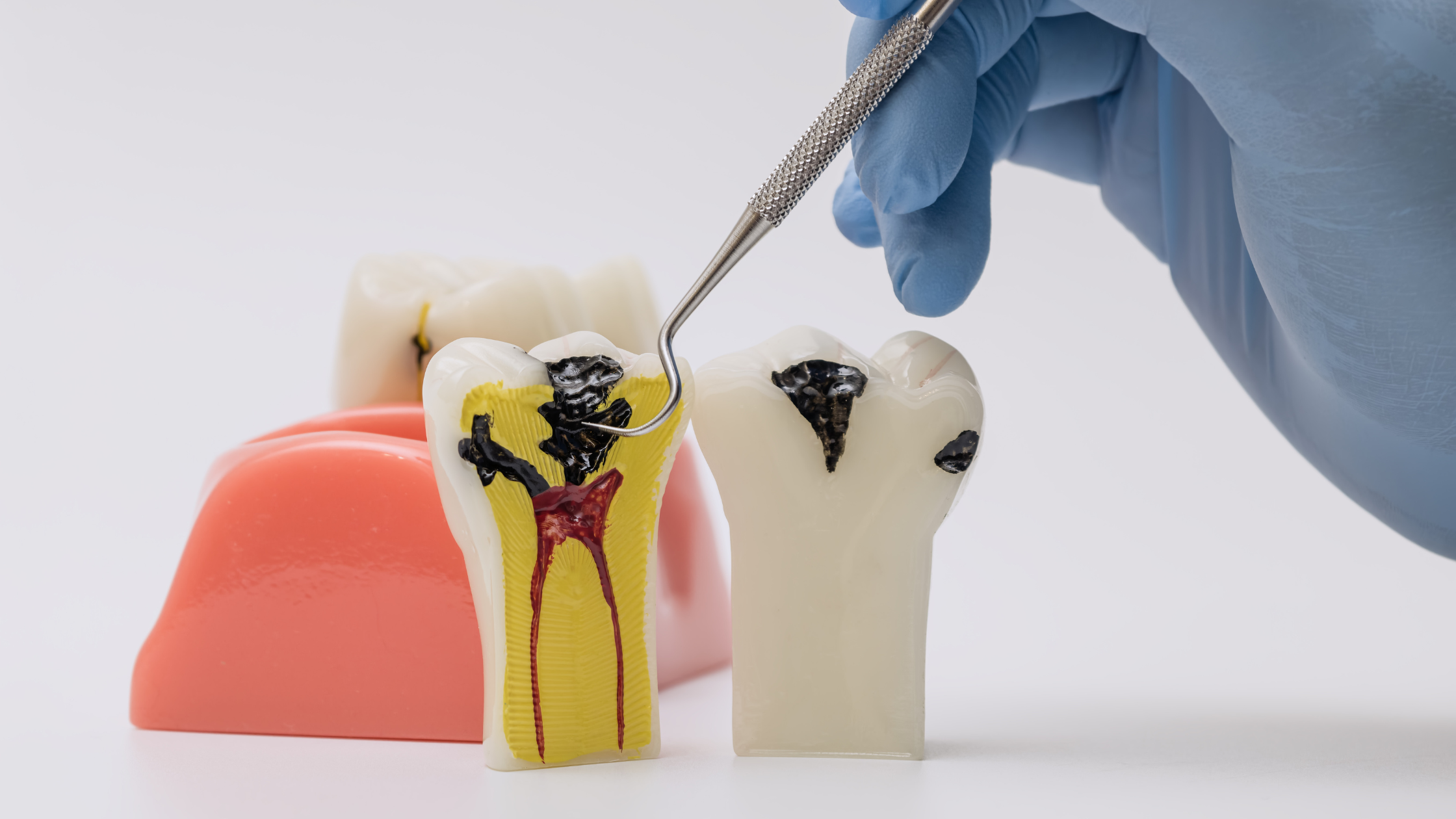 infection control procedures in a dental office